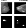 Deeply supervised U‐Net for mass segmentation in digital mammograms