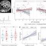 Microstructural imaging and transcriptomics of the basal forebrain in first-episode psychosis