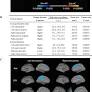 Prognostic associations of cortical gyrification in minimally medicated schizophrenia in an early intervention setting