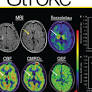 Cerebral Air Embolism: Radiologic and Pathologic Correlation
