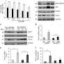 Inhibition of AKT promotes FOXO3a-dependent apoptosis in prostate cancer