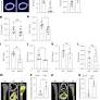 Serum amyloid P secreted by bone marrow adipocytes drives skeletal amyloidosis