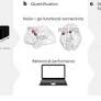 A cognitive neural circuit biotype of depression showing functional and behavioral improvement after transcranial magnetic stimulation in the B-SMART-fMRI trial