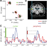 What Does Motor Efference Copy Represent? Evidence from Speech Production