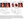 Evaluation of [68Ga]Ga-NOTA-CTP in CD1 mice with myocardial infarction