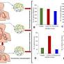 SARS-CoV-2 infection reduces human nasopharyngeal commensal microbiome with inclusion of pathobionts
