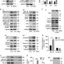Induction of intestinal stemness and tumorigenicity by aberrant internalization of commensal non-pathogenic E. coli