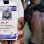Class 12th student shot in Malda, TMC link alleged: Victim in critical condition, BJP blames police inactio...