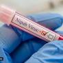 Nipah virus: Advanced ‘mobile laboratory’ from Pune NIV sent to West Bengal as virus hits health care workers