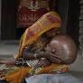 Hydrocephalus is rare but potentially deadly if left untreated – Dr Gwenetta Curry