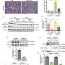 Xbp1s-FoxO1 axis governs lipid accumulation and contractile performance in heart failure with preserved ejection fraction