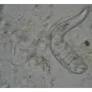 Dermatitis due to Mixed Demodex and Sarcoptes Mites in Dogs