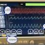 Automated Oxygen Delivery in Neonatal Intensive Care