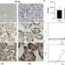 Presence of entry receptors and viral markers suggest a low level of placental replication of hepatitis B virus in a proportion of pregnant women infected with chronic hepatitis B