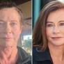 Former Model, 65, Gets Dramatic Facelift Ahead of Wedding | Before-and-After Photos (Exclusive)