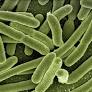 Searching for Sepsis Interventions