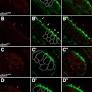Zebrafish Models for the Mechanosensory Hair Cell Dysfunction in Usher Syndrome 3 Reveal That Clarin-1 Is an Essential Hair Bundle Protein