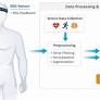 Intelligent decision-making systems for early detection of alzheimer’s disease using wearable technologies and deep learning
