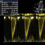 Cardiac output assessment in pregnancy: comparison of two automated monitors with echocardiography