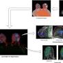 Performance of an AI-powered visualization software platform for precision surgery in breast cancer patients