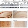 Fragile X mental retardation protein expression in Alzheimer’s disease